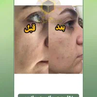 آموزش روغن درمانی ویژه|خدمات آموزشی|خاش, |دیوار