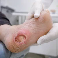 پانسمان زخم بستر و دیابتی، تزریقات در منزل شیراز|خدمات زیبایی و سلامت|شیراز, معالیآباد|دیوار