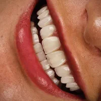 لابراتوار دندان سازی/ترمیم انواع دندان شکسته