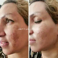 کرم معجزه اصل آلمانی ، ایتالیایی با بهترین مواد|آرایشی، بهداشتی، درمانی|لردگان, |دیوار