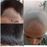 طب سنتی|آرایشی، بهداشتی، درمانی|انگوران, |دیوار