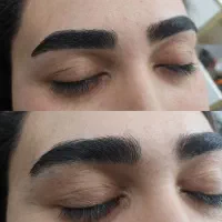 اصلاح ابرو تخصصی