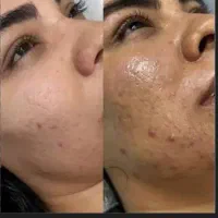 پاکسازی پوست