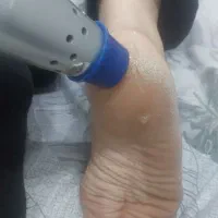 فیزیوتراپی در منزل و کلینیک