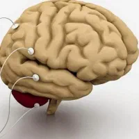 تجربه و راهنمایی در مورد اختلال یادگیری