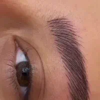 فیبروز .شیدینگ لب . میکروبلیدینگ