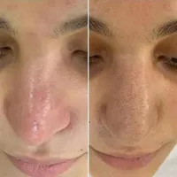 فیشیال تخصصی با بهترین مواد|خدمات آرایشگری و زیبایی|مشهد, چهارچشمه|دیوار