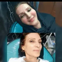 ژل لب|خدمات آرایشگری و زیبایی|شهرضا, |دیوار