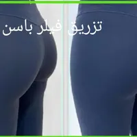 تزریق فیلرهای بدن(دست-مچ پا-باسن)ساکشن غبغپ|خدمات آرایشگری و زیبایی|اصفهان, ملک‌شهر|دیوار