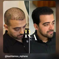 کاشتمو و ابرو