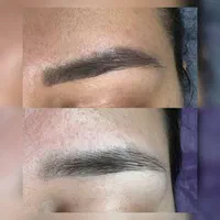 پاک کردن تتو .لیزر.پاککردن خالکوبی .ریموو تتو.prp|خدمات آرایشگری و زیبایی|اصفهان, خلجا|دیوار