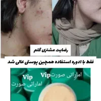 کرم معجزه گر وی ای پی بشدت قوی صورت دست پا|آرایشی، بهداشتی، درمانی|اهواز, کوی باهنر|دیوار