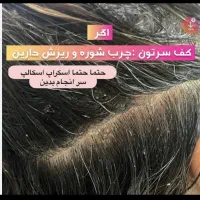 درمان قطعی موخوره و ریزش مو رایگان شد.تاپایان آبان