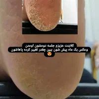 پدیکور وکفسابی