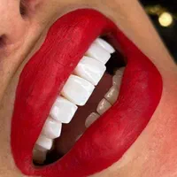 کامپوزیت دندان|خدمات آرایشگری و زیبایی|اردبیل, |دیوار