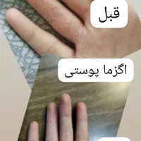 درمان معجزه گر|آرایشی، بهداشتی، درمانی|شاهینشهر, فردوسی|دیوار