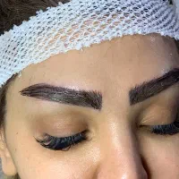 اموزش کاشت مو و ابرو فیلر و بوتاکس