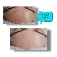 اموزش وخدمات پاکسازی پوست آقاخانوم(تخفیف)ویال مو