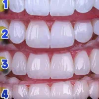 دندان پزشکی با اقساط 10 ماه بدون سود