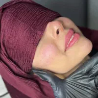 تزریق فیلر و بوتاکس و آنزیم با بهترین کیفیت|خدمات آرایشگری و زیبایی|قم, صدوق|دیوار