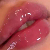 بوتاکس وفیلر