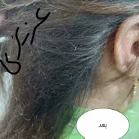 درمان صدرصدقطعی وتضمینی شپش ورشک|آرایشی، بهداشتی، درمانی|نورآباد, |دیوار