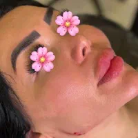 جشنواره تخفیف فیلر بوتاکس|خدمات آرایشگری و زیبایی|اهواز, کیانپارس |دیوار