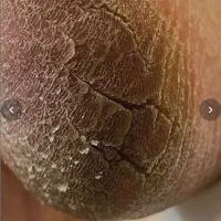 نیازمند مدل رایگان برای پدیکور و کفسابی سعادت اباد