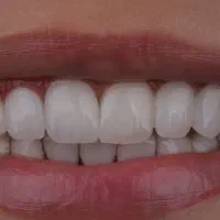 خدمات دندان پزشکی