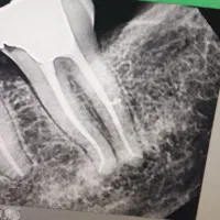 کلینیک دندانپزشکی در کمپلو ارائه تمام خدمات دندان|خدمات زیبایی و سلامت|اهواز, کمپلو جنوبی|دیوار