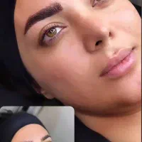 میکروبلیدینگ و فیبروز صورت بدون درد و خونریزی|خدمات آرایشگری و زیبایی|گلبهار, شهر جدید گلبهار|دیوار