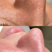 فیشیال  و پاکسازی صورت بانوان و آقایون