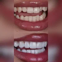 خدمات درمانی و زیبایی دندان|خدمات آرایشگری و زیبایی|کرمانشاه, |دیوار