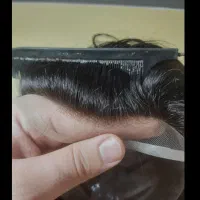 پروتز مو|آرایشی، بهداشتی، درمانی|تهران, نارمک|دیوار