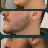 ۳۰ روزه ریش هات رو پرپشت کن