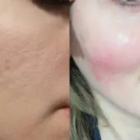 کلینیک زیبایی|خدمات آرایشگری و زیبایی|قم, باسکول|دیوار