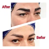 کاشت ابرو دائمی و قابل رشدVIP/جراحی و غیرجراحی|خدمات آرایشگری و زیبایی|اراک, |دیوار