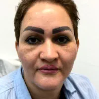 جشنواره یلدایی ژل بوتاکس پی ارپی فیلر بیکینی|خدمات آرایشگری و زیبایی|مشهد, سرافرازان|دیوار