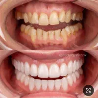 دندانپزشکی/کامپوزیت/ لمینیت/ ایمپلنت/ روکش|خدمات آرایشگری و زیبایی|تهران, هفت حوض|دیوار