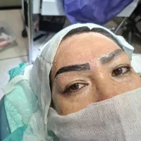 کاشت ابرو اقساط