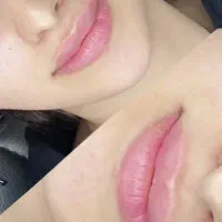 زیبایی و جوانی باجوان سازی طبیعی/اگزوزوم/ژل/بوتاکس|خدمات آرایشگری و زیبایی|تهران, صادقیه|دیوار