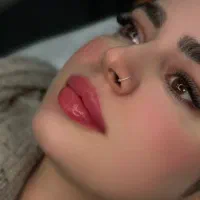 تزریق ژل و بوتاکس و مزو و پی آرپی