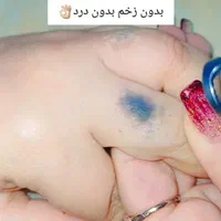 کربن تراپی(پلینگ هالیوودی)|خدمات آرایشگری و زیبایی|یزد, |دیوار