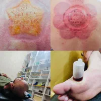 دیسک سیاتیک فیزیوتراپی کاردرمانی زالو درمانی حجامت|خدمات آرایشگری و زیبایی|تهران, ارامنه|دیوار
