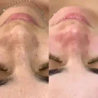 آموزش و کار حرفه ای الگاپیل و فیشیال صورت و بدن