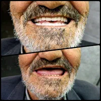 دندان مصنوعی(بدون واسطه خرید کن)|خدمات آرایشگری و زیبایی|قرچک, باقرآباد|دیوار