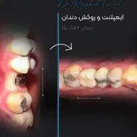 ادمین مدیریت کامل پیج اینستاگرام بله و...هستم