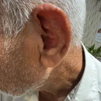 سمعک|پزشکی|تهران, شمسآباد|دیوار