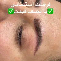 میکروبلیدینگ و شیدینگ لب