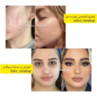 دوست داری ۱۰ سال جوان تربشوی پوست صاف میخوای|آرایشی، بهداشتی، درمانی|اردکان, |دیوار